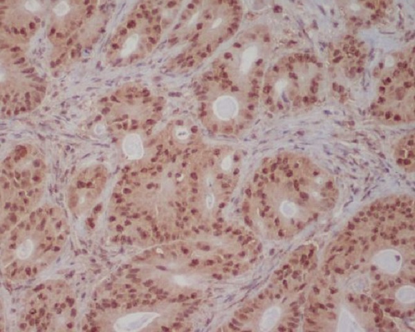 PI3 Kinase p85 beta Rabbit mAb