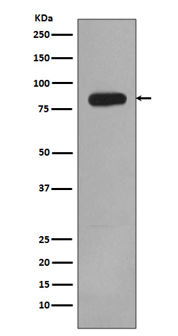 PI3 Kinase p85 beta Rabbit mAb