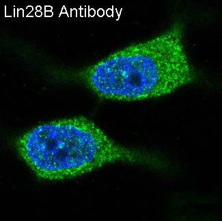 LIN28B Rabbit mAb