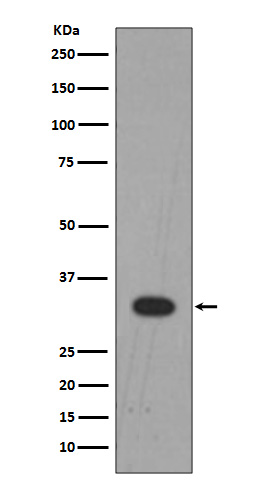 LIN28B Rabbit mAb