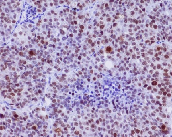 Phospho-c-Myc (Ser62) Rabbit mAb