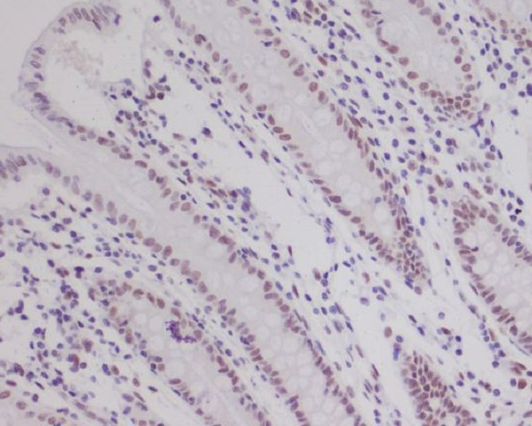 HIF1 beta Rabbit mAb