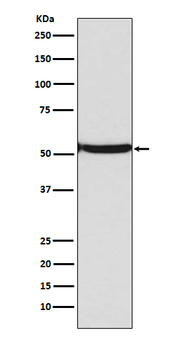 Acetyl-p53 (Lys382) Rabbit mAb