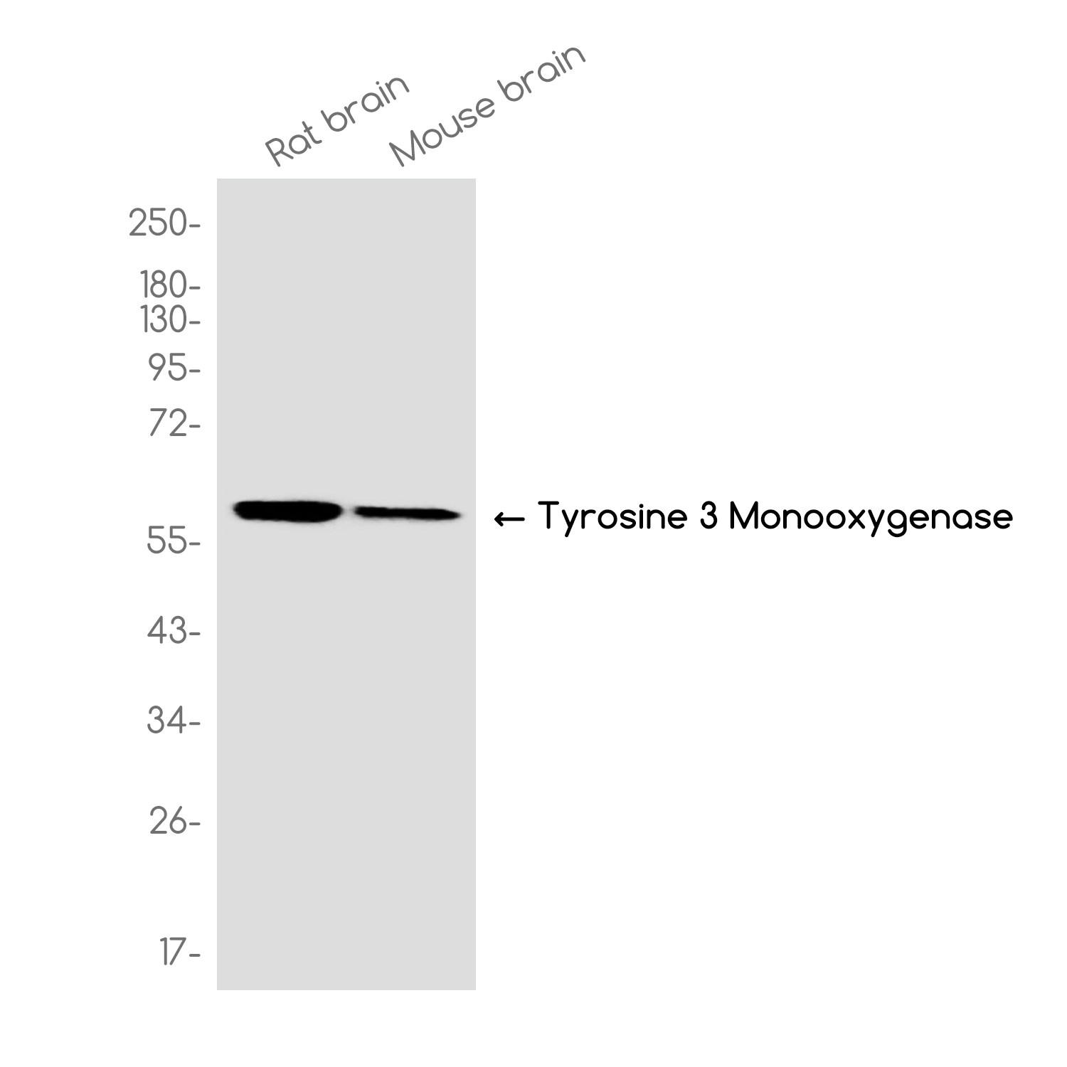 Tyrosine Hydroxylase Rabbit mAb