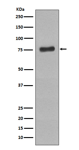 Phospho-BTK (Tyr223) Rabbit mAb