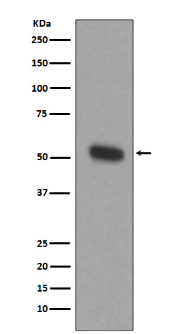 Tryptophan 5 Hydroxylase 1 Rabbit mAb