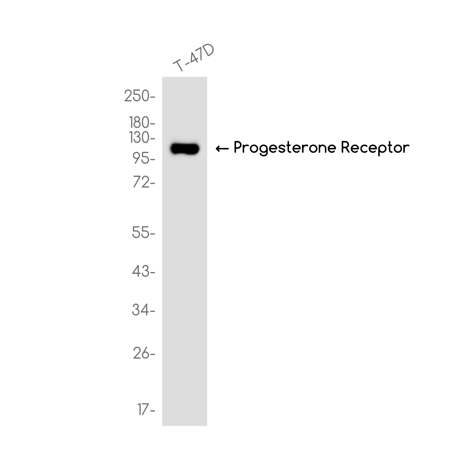 Progesterone Receptor Rabbit mAb