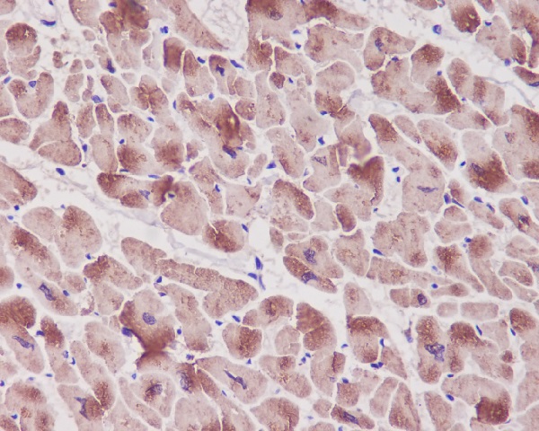 Cardiac Troponin I Rabbit mAb