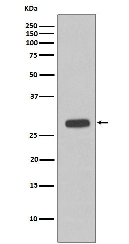 Cardiac Troponin I Rabbit mAb