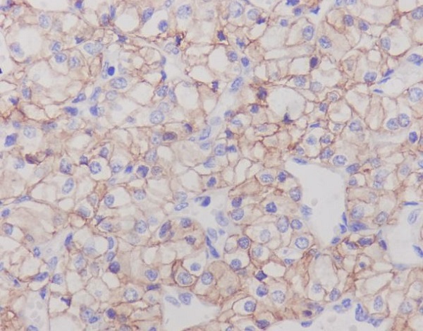 Carbonic Anhydrase 9 Rabbit mAb