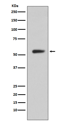 Carbonic Anhydrase 9 Rabbit mAb