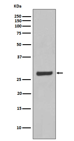 Aquaporin 5 Rabbit mAb