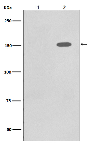 Phospho-EGFR (Tyr1086) Rabbit mAb