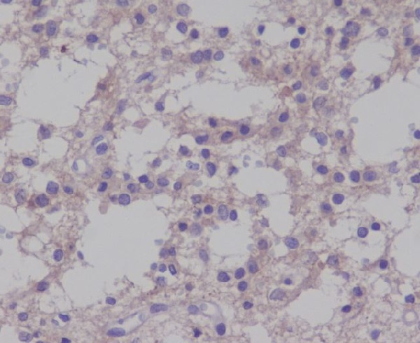 Phospho-TrkB (Tyr817) Rabbit mAb