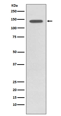 Phospho-TrkB (Tyr817) Rabbit mAb