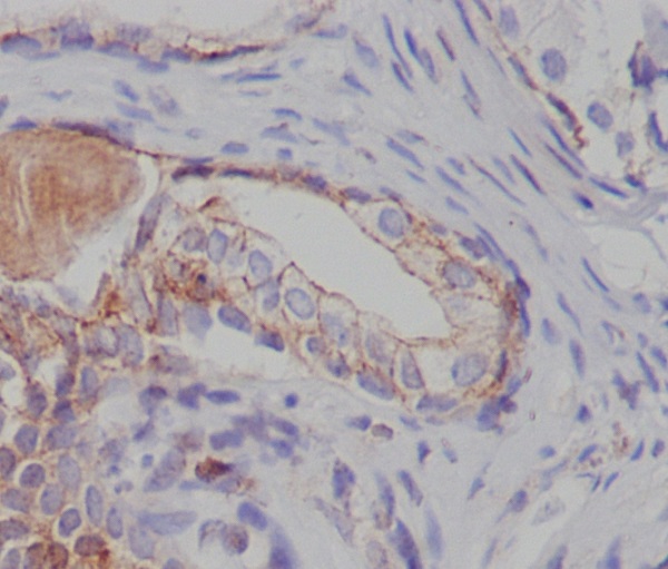 Tuberin Rabbit mAb