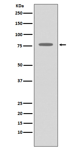 GRK2 Rabbit mAb