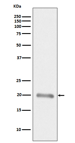 MelanA Rabbit mAb