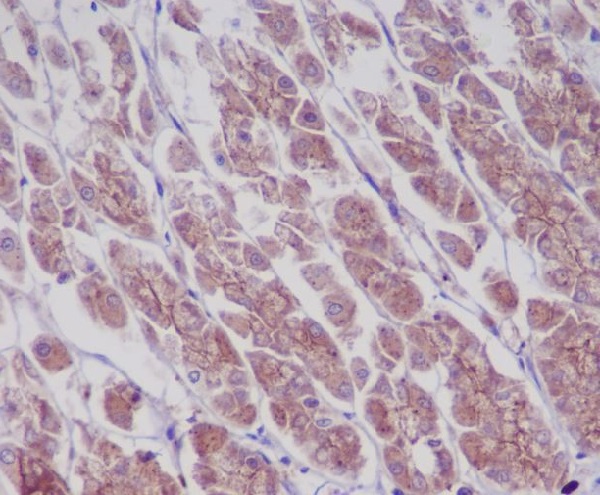 Phospho-EGFR (Tyr1173) Rabbit mAb