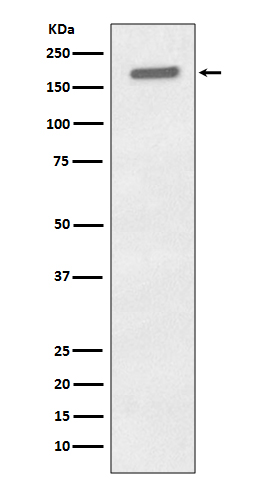 Phospho-EGFR (Tyr1173) Rabbit mAb