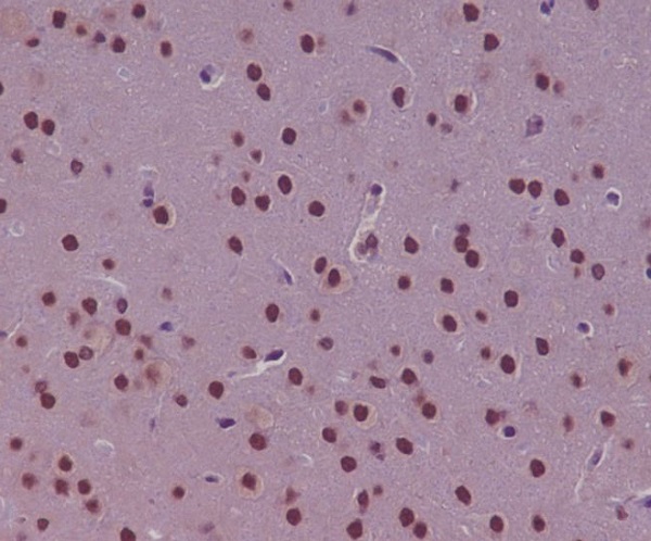 p73 Rabbit mAb