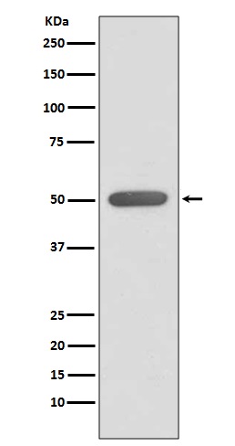 ERR alpha Rabbit mAb