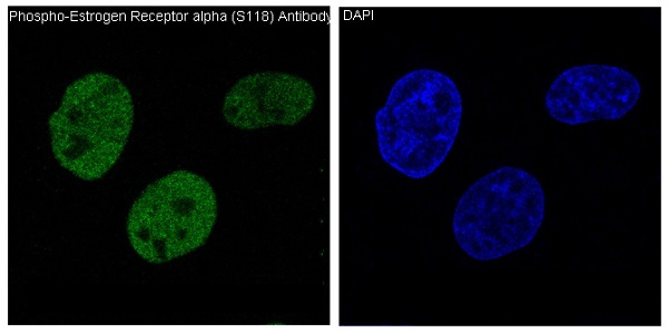 Phospho-Estrogen Receptor alpha (Ser118) Rabbit mAb