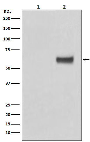 Phospho-Estrogen Receptor alpha (Ser118) Rabbit mAb