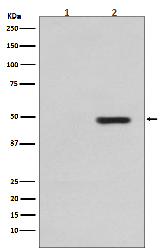 Phospho-Tau (Thr231) Rabbit mAb