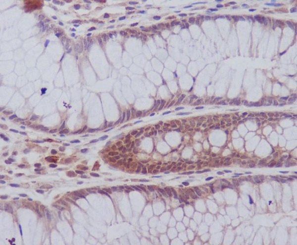 PYK2 Rabbit mAb