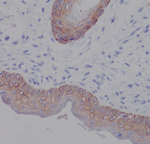 Cytokeratin 5 Rabbit mAb