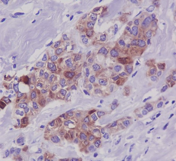 Phospho-Tau (Ser396) Rabbit mAb