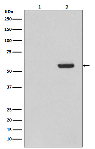 Phospho-Tau (Ser396) Rabbit mAb