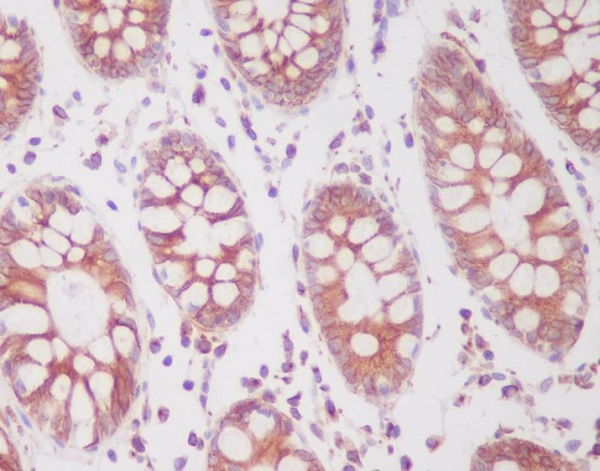 Phospho-SIRT1 (Ser47) Rabbit mAb