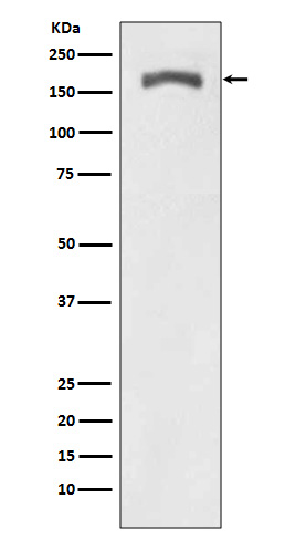 Phospho-PDGFR beta (Tyr740) Rabbit mAb