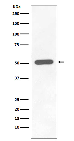 Phospho-Chk1 (Ser296) Rabbit mAb