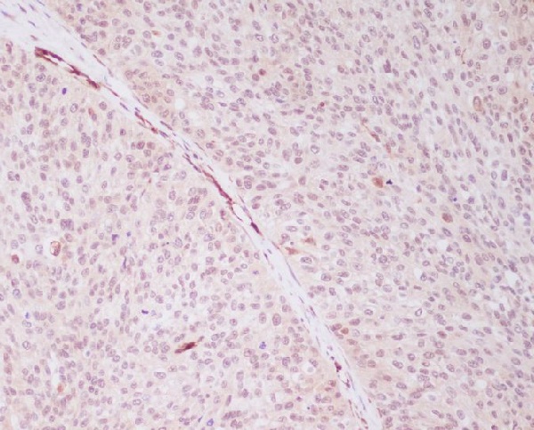 PRPF19 Rabbit mAb