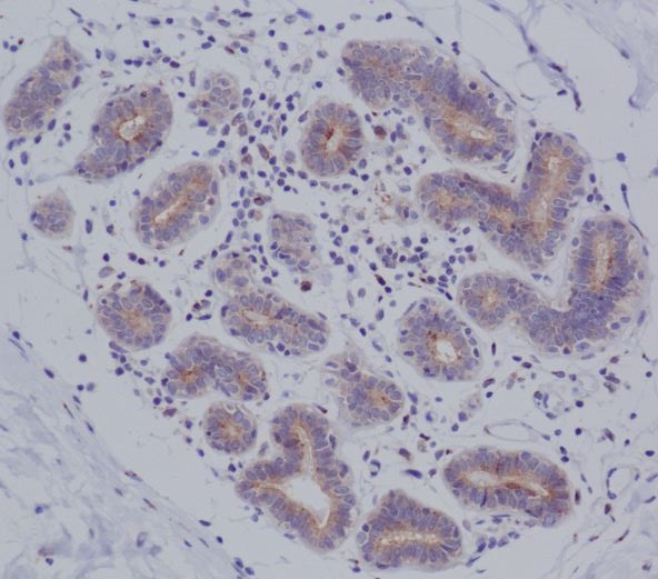 MyD88 Rabbit mAb