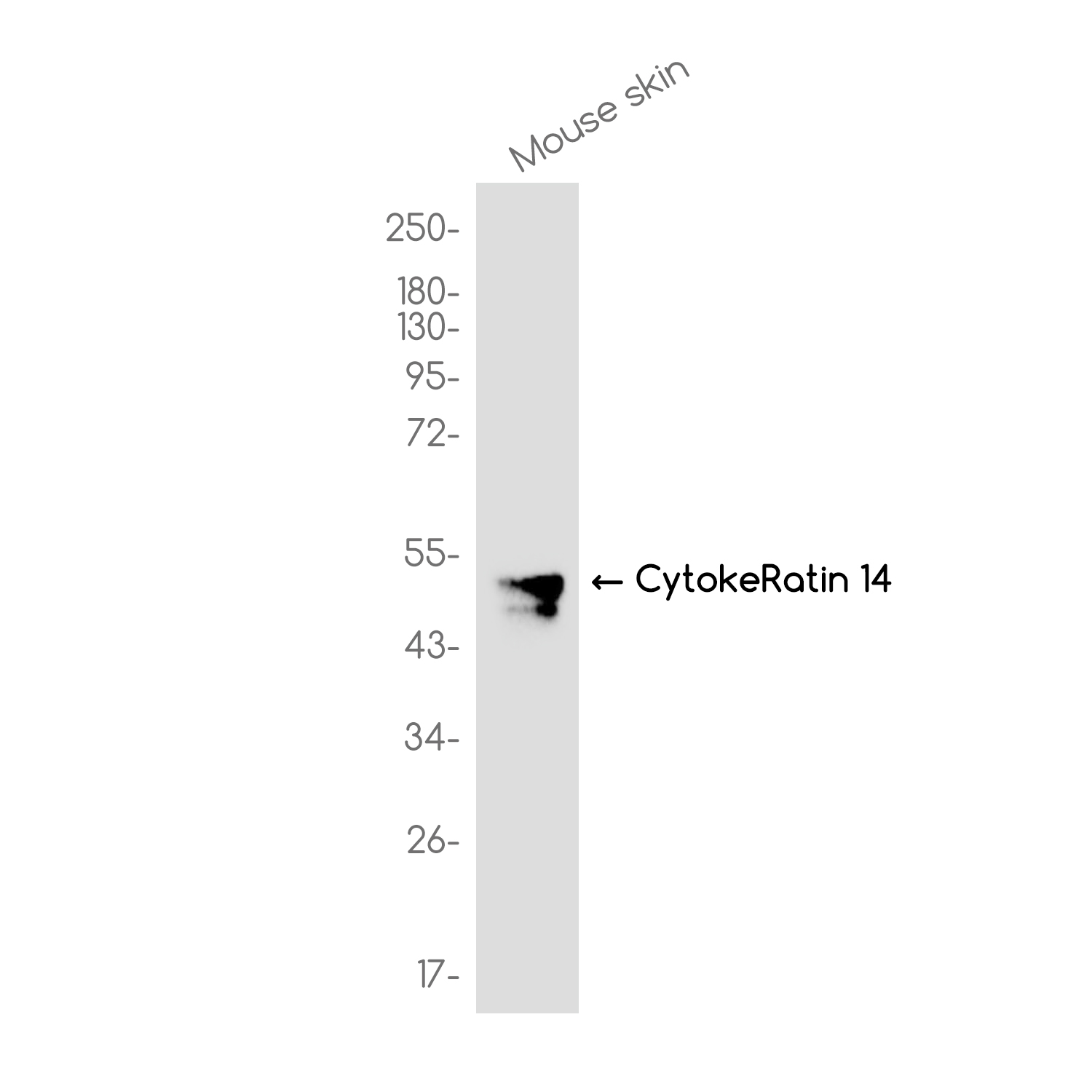 Cytokeratin 14 Rabbit mAb