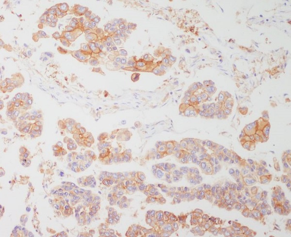 HLA DR Rabbit mAb