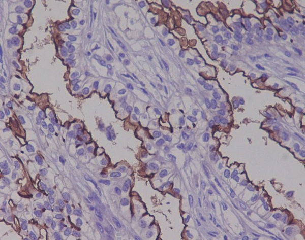 Mucin 1 Rabbit mAb