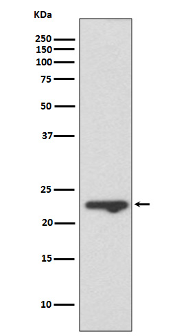 Mucin 1 Rabbit mAb