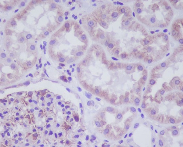 Adiponectin Receptor 1 Rabbit mAb