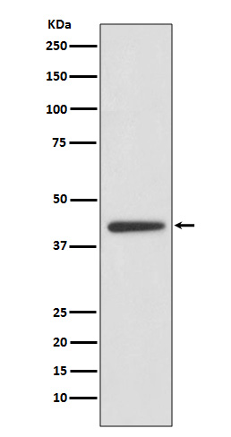 Adiponectin Receptor 1 Rabbit mAb