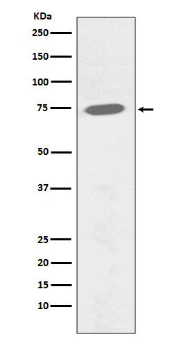 Phospho-BTK (Tyr551) Rabbit mAb