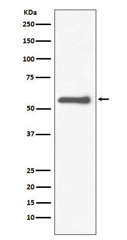 Tyrosine Hydroxylase Rabbit mAb