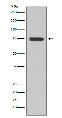 BTK Rabbit mAb