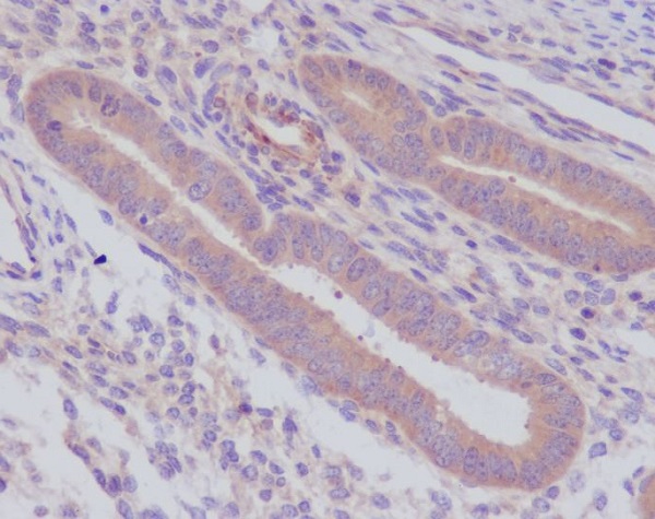 Caspase 8 Rabbit mAb