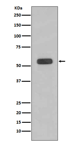 Caspase 8 Rabbit mAb