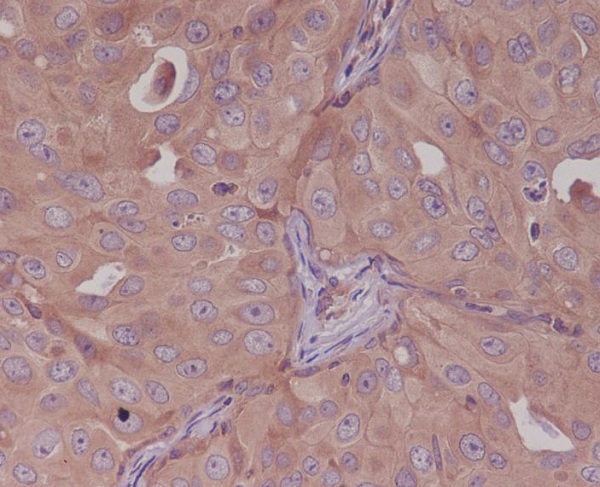 Bcl10 Rabbit mAb